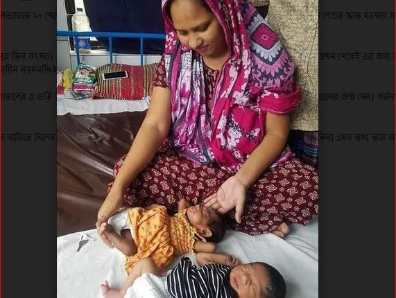 জমজ সন্তান জন্ম ৩৯ দিন আগে পরে